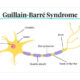 Guillain-Barré Syndrome Wiki (January 2022) Know The Authentic Details!