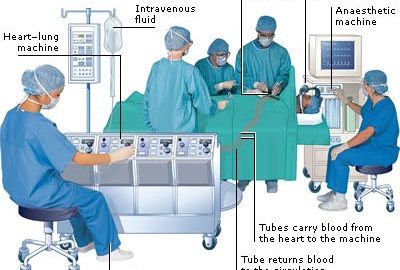 Salary Cardiovascular Perfusionist (August 2022) Education required, Job duties, Complete Details!